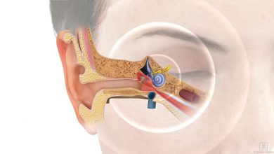 कान बजने का स्थायी इलाज भी अब संभव होगा