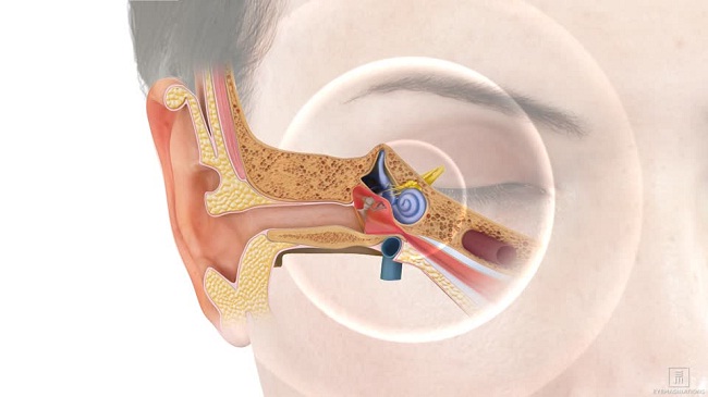 कान बजने का स्थायी इलाज भी अब संभव होगा