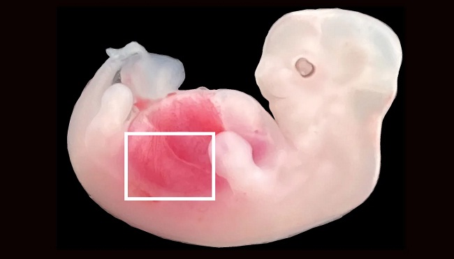 सूअर के अंदर मानवभ्रूण के गुर्दे विकसित