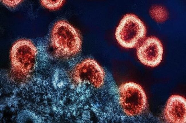 एचआईवी वैक्सिन का सफल परीक्षण